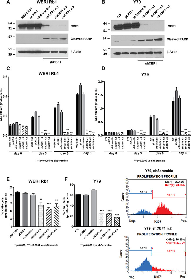 Genetic downregulation of CBF1 inhibits growth and proliferation of retinoblastoma cells.