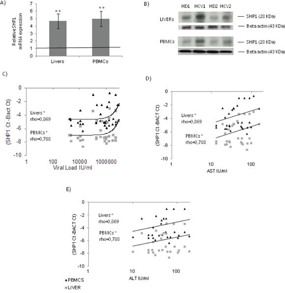 SHP1 expression in chronic HCV patients.