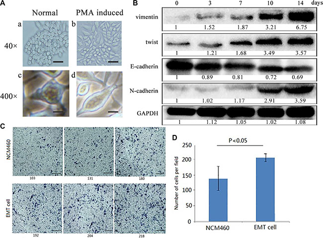 Colon epithelial NCM460 cells were induced into EMT- featured cells by PMA treatment.