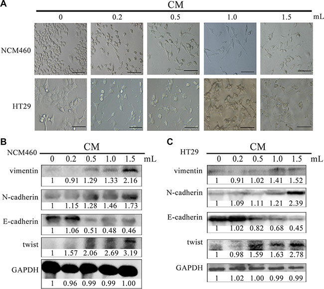 CM derived from EMT cells induced NCM460 and HT29 cells to exhibit EMT features.