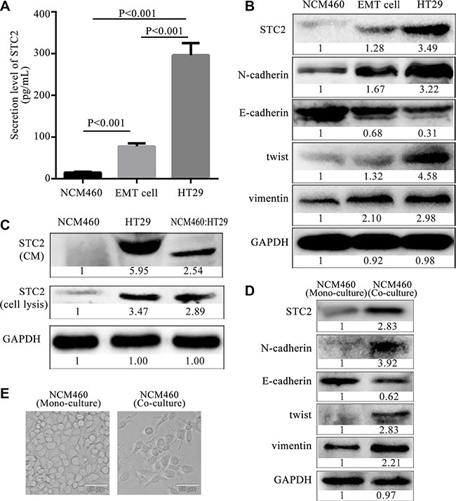 Expression and secretion level of STC2 from epithelia, EMT and colon cancer cells.