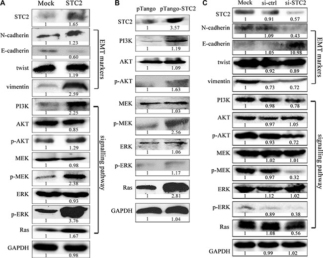 STC2 promotes EMT process via AKT and ERK signaling pathways.