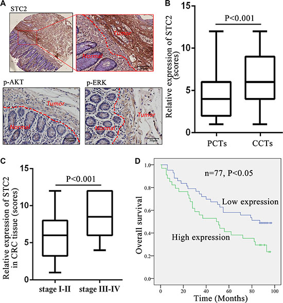 STC2 expression level in colorectal cancer tissues correlated with tumor stage and patient survival.