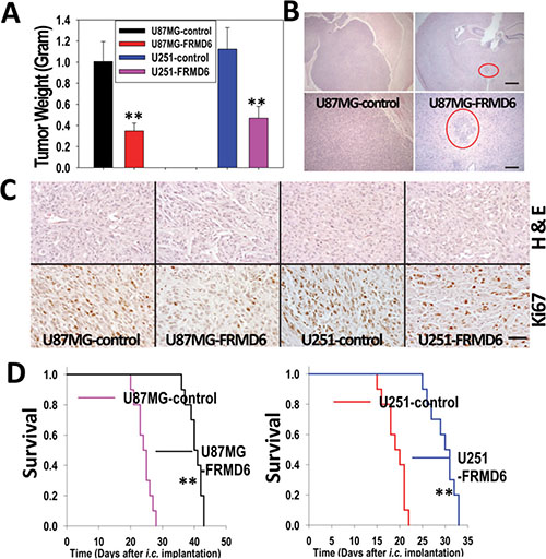 Increased FRMD6 expression inhibits subcutaneous and intracranial GBM growth and progression.