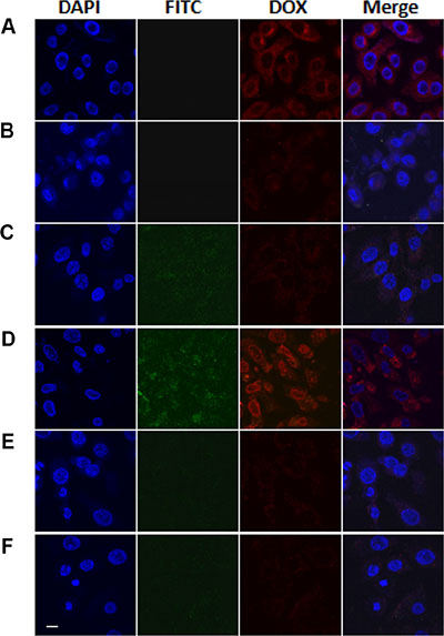 CLSM images of MCF-7 cells treated with free DOX (A), MSN/COOH/DOX (B), MSN/COOH/TAT-FITC/DOX (C) or MSN/COOH/TAT-FITC/Cit/YSA- BHQ1/DOX (D).