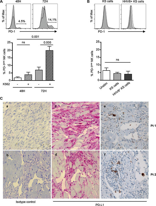 Relationships between tumor cells and NK cell PD-1 expression.