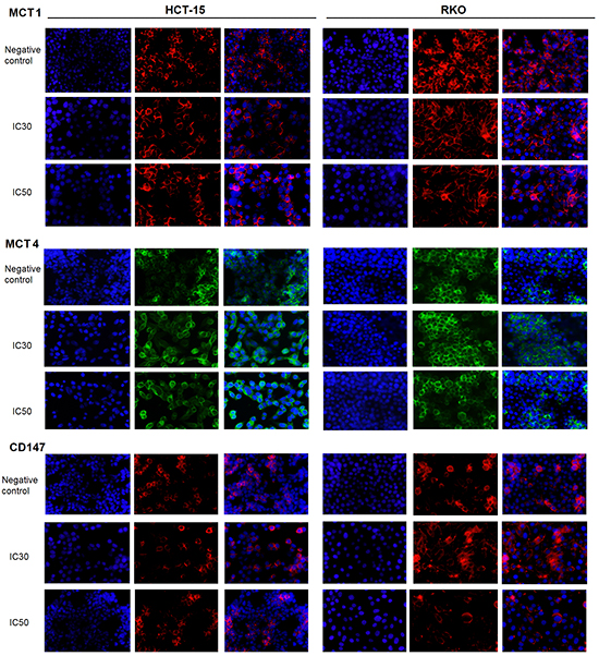 Localization of MCT1, MCT4 and CD147 in CRC cells after acetate treatment.