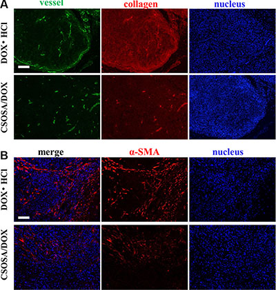 Damage to the microenvironment caused by CSOSA/DOX.