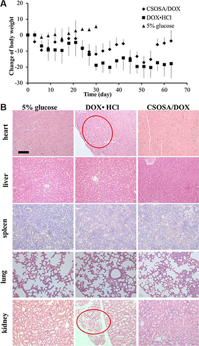 Systemic toxicity caused by DOX.