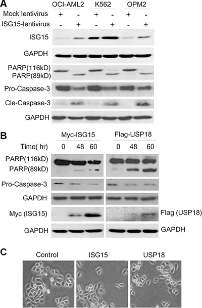 Ectopic ISG15 and USP18 induces cancer cell apoptosis.