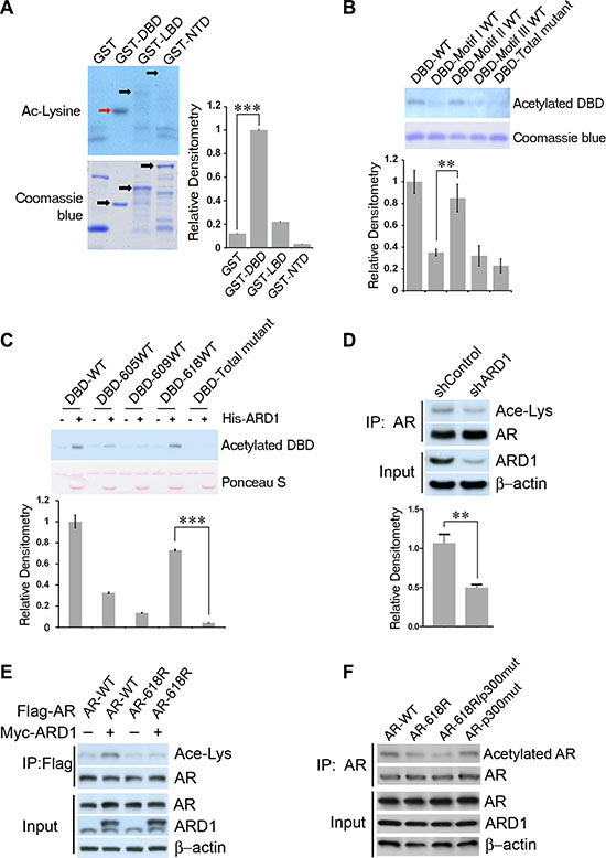 AR is acetylated by ARD1 at K618 in vivo and in vitro.