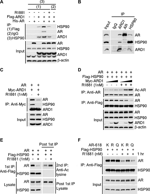ARD1-mediated AR acetylation drives ligand-induced AR-HSP90 dissociation.