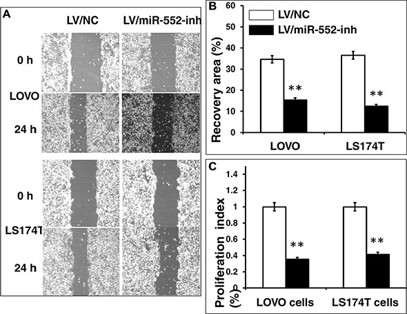 Inhibition of miR-552 reduces LOVO and LS174T CRC cell migration and proliferation in vitro.
