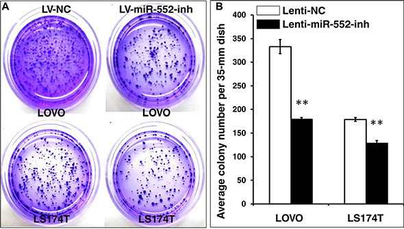 Inhibition of miR-552 suppresses the clonogenicity in LOVO and LS174T CRC cells.