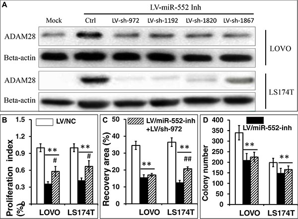 Knockdown of ADAM28 expression enhances the proliferation, migration and clonogenicity in LOVO and LS174T CRC cells.