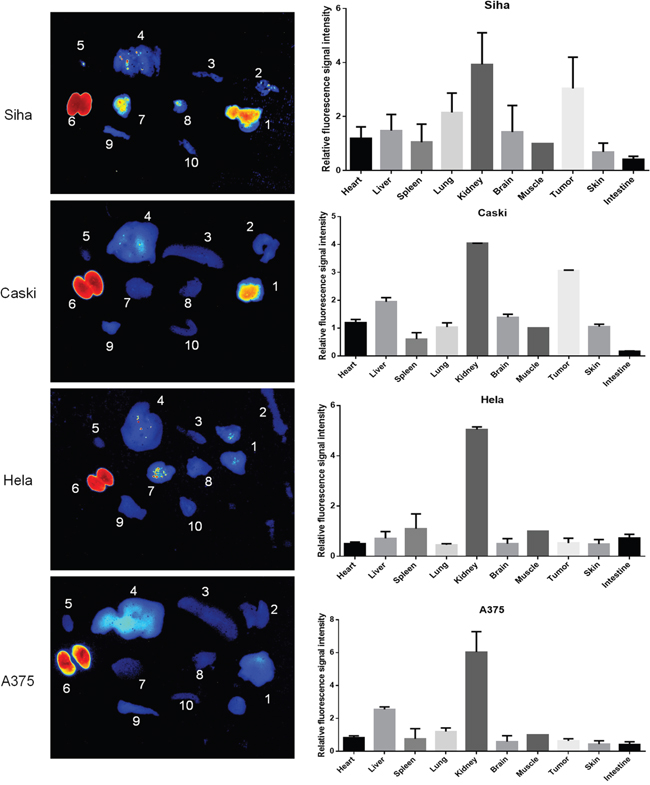 Ex vivo imaging of the fluorescence retention of Dylight755-labelled Z HPV16 E7384 affibody in different tissues.