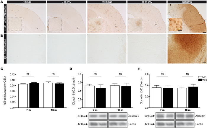 WD does not induce infiltration of immune cells  or IgG extravasation in the brain parenchyma since the BBB integrity is not compromised.