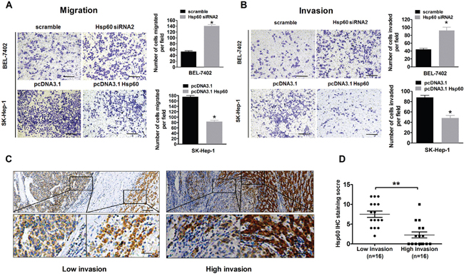 Ectopic expression of Hsp60 inhibits invasion and migration of HCC cells invitro.