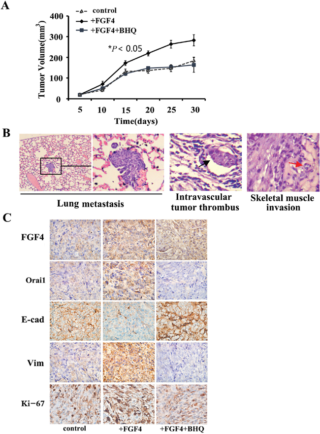 BHQ inhibits in vivo tumor growth and metastasis caused by FGF4 in a H1299 xenograft mouse model, induces the expression of E-cadherin, and decreases the expression of Orai1 and Vimentin in tumor tissues.