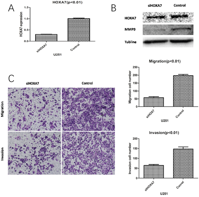 HOXA7 knockdown inhibits glioma cell migration and invasion in vitro.