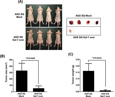 The effect of galectin-7 over-expression on tumor growth of xenografts in nude mice.