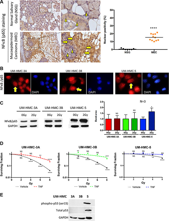 Activation of NF&#x03BA;B in MEC.