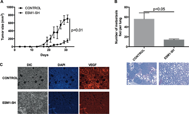 ESM1 knockdown inhibits MOC tumor growth and metastasis in vivo.