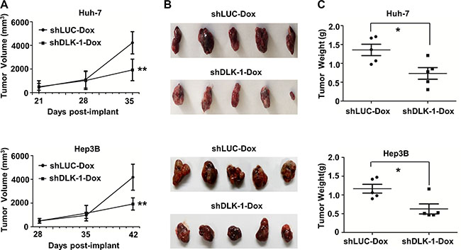 DLK1 knockdown can suppress xenograft tumor growth in nude mice.