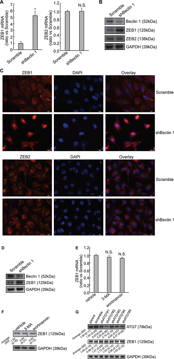 Upregulation of ZEB1 by Beclin 1 knockdown in thyroid cancer cells.