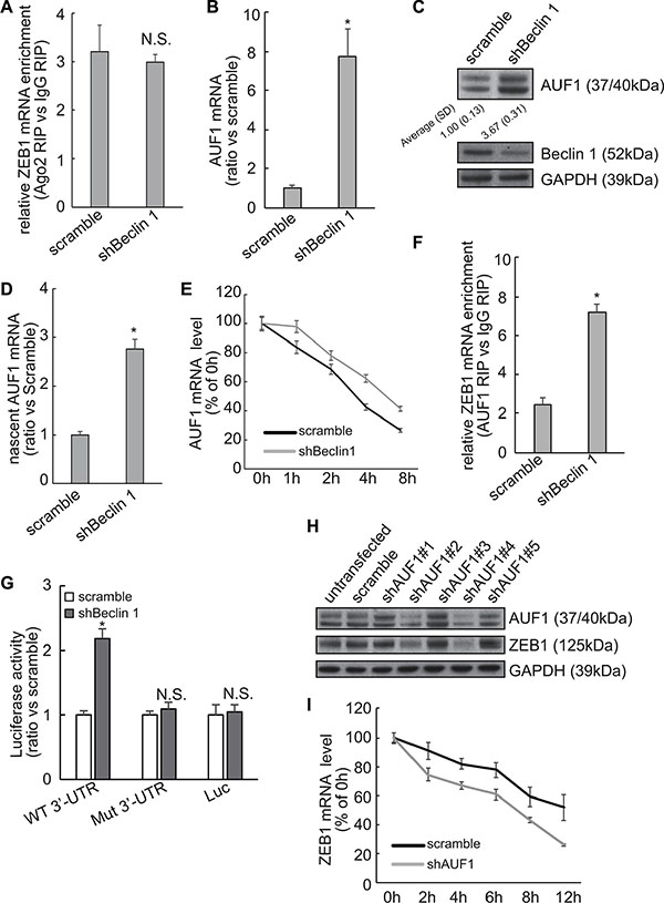 Involvement of AUF1 in stabilization of ZEB1 mRNA by Beclin 1 knockdown in FRO cells.