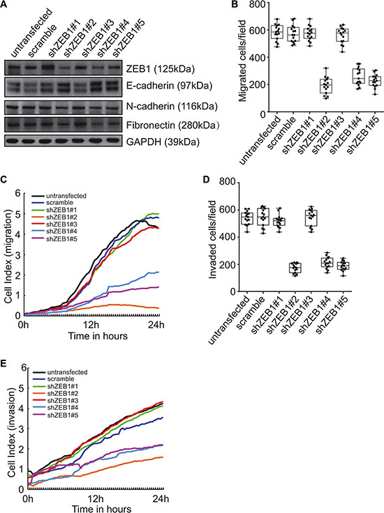 Involvement of ZEB1 in induction of EMT and promotion of invasion by Beclin 1 knockdown in FRO cells.