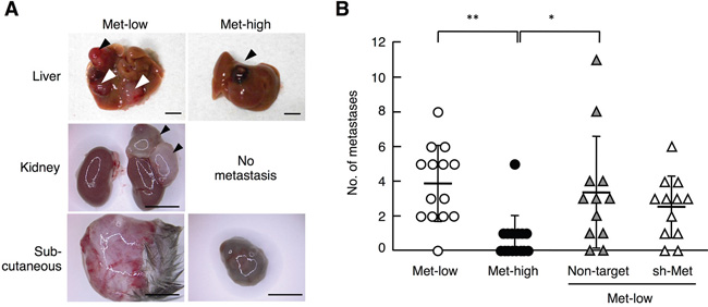 Metastasis of Met-low and Met-high cells to organs other than lungs.