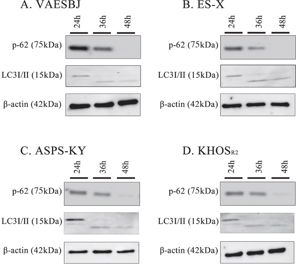 Arginine deprivation induces autophagy in Dox-resistant sarcoma cells.