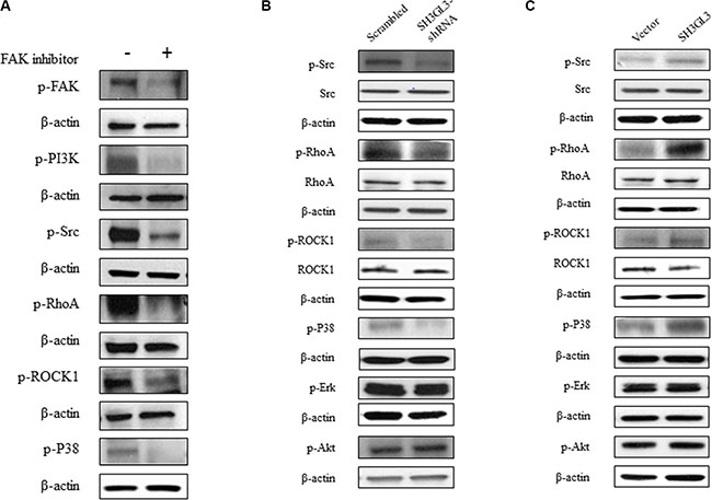 The activation status of Src, RhoA, ROCK1, P38, ERK, and AKT in the myeloma cells treated with FAK inhibitor or myeloma cells with suppressed and overexpressed SH3GL3.