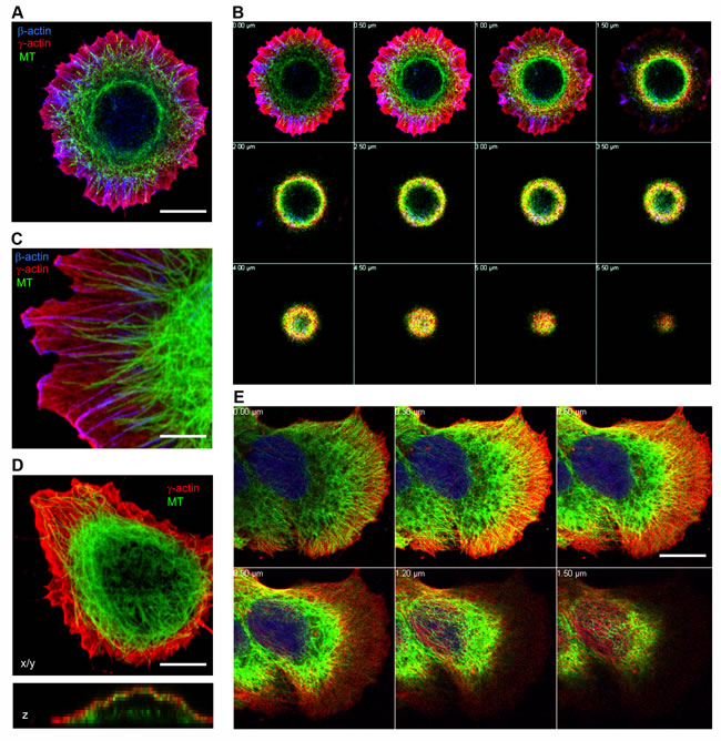 Subcellular localization of cytoplasmic actins and microtubules in spreading epithelial cells.