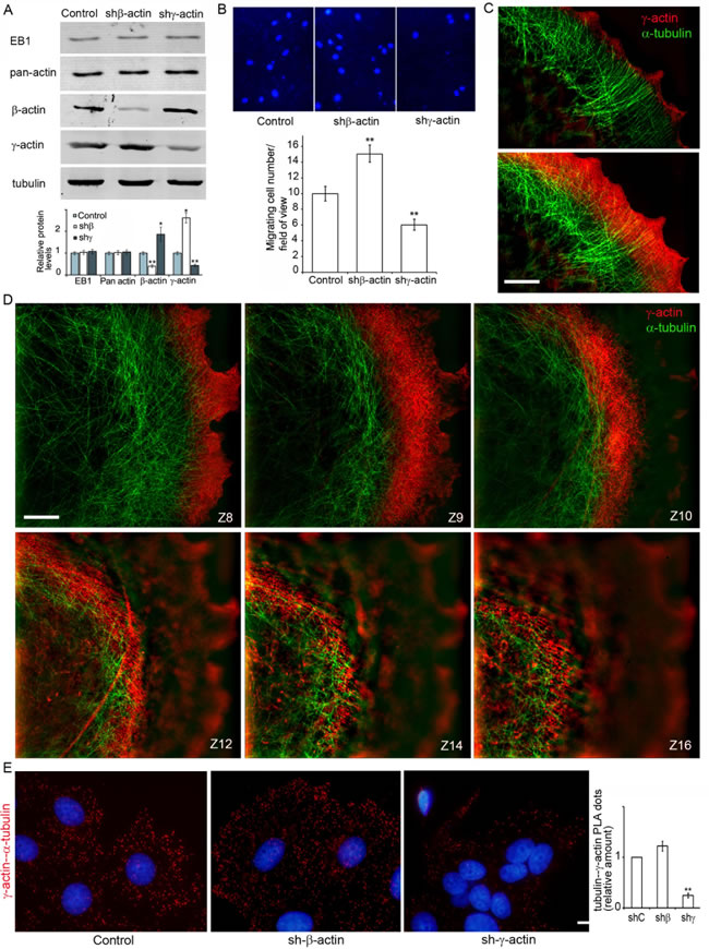 &#x3b3;-actin-microtubule interaction after actin isoform down-regulation.