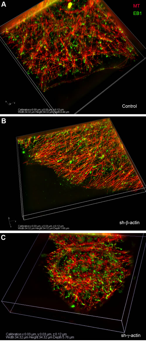 EB1-positive comet distribution in MCF7 cells with down-regulated &#x3b2;- or &#x3b3;-actin.