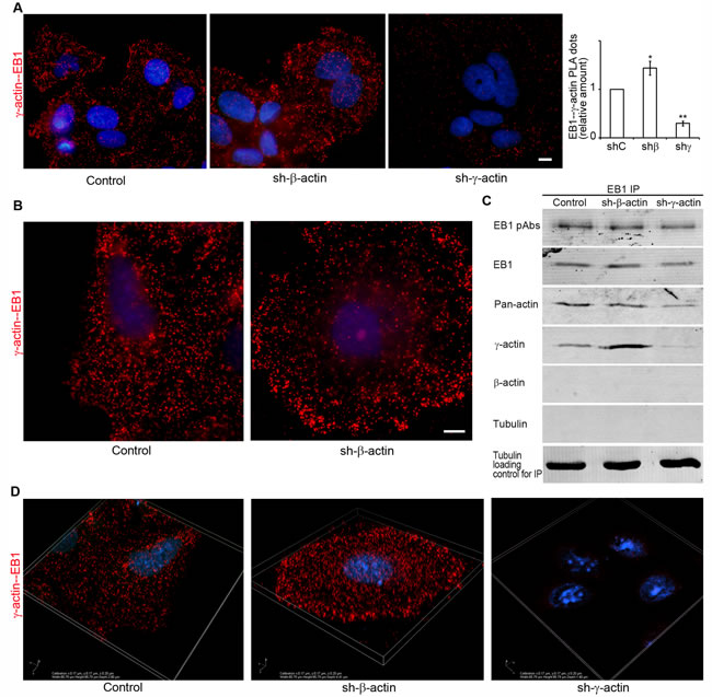 Selective interaction of EB1 with the cytoplasmic &#x3b3;-actin isoform.