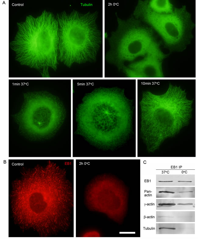 Interaction of EB1 with microtubules and the cytoplasmic &#x3b3;-actin isoform in different conditions of tubulin polymerization.