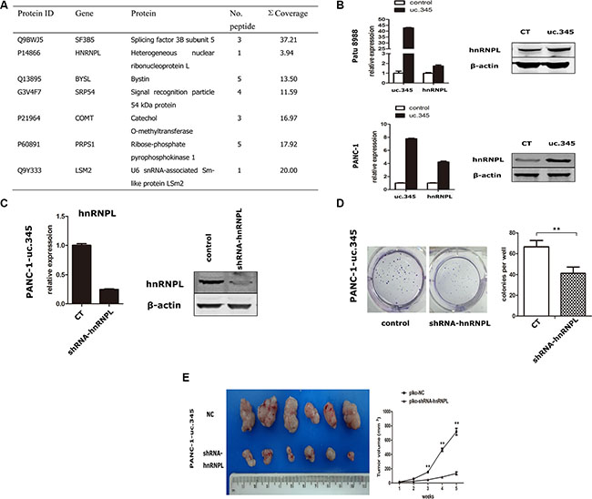 uc.345 promotes PC cells tumorigenecity depending on hnRNPL.