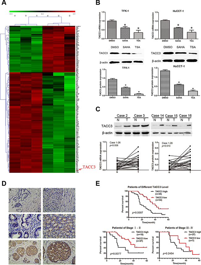 Microarray analysis indicates TACC3 as a molecular drug target of HDAC inhibitors, and the expression of TACC3 correlates with the prognosis of CCA patients.