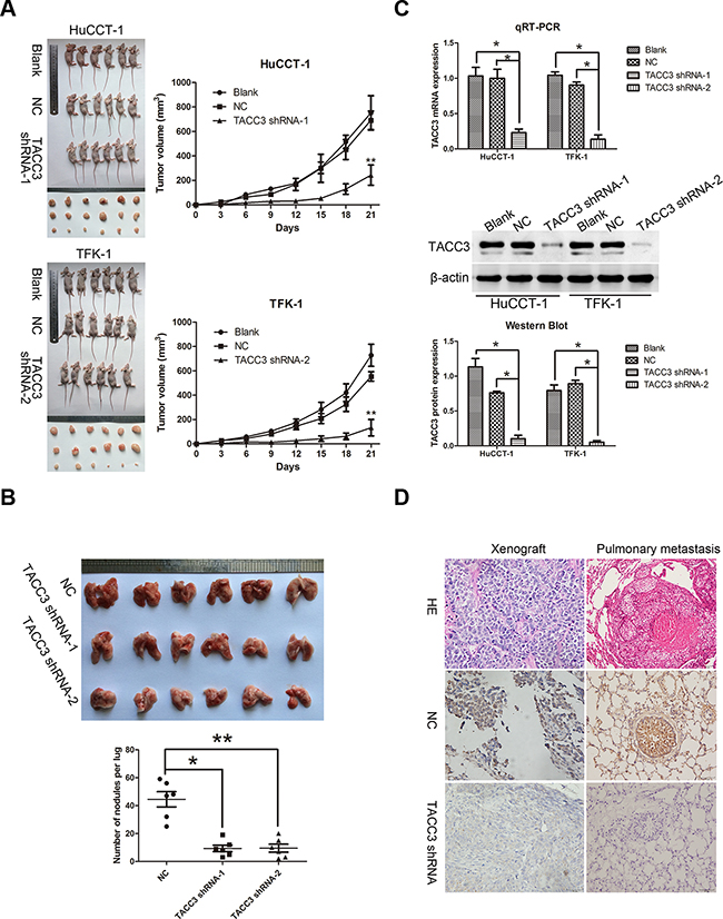 Targeted silencing of TACC3 suppresses CCA tumorigenicity and metastasis, in vivo.