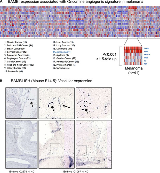 Five genes of the Oncomine angiogenesis gene signature were co-regulated with Bambi transcripts in melanoma compared to other cancers (&#x003E; 1.5-fold-change, p &#x003C; 0.001).