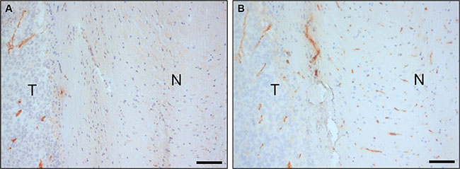 In vivo biopanning of a Llama phage library in an animal model of orthotopic glioma.