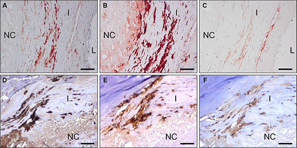 C-C7 recognizes blood vessels and macrophages in human atherosclerosis.