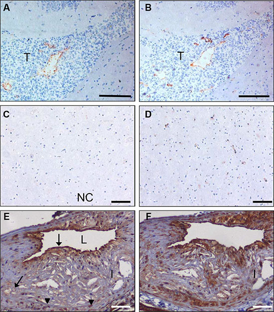 In vivo targeting of glioma xenografts and atherosclerotic lesions by C-C7-displaying M13 phages.