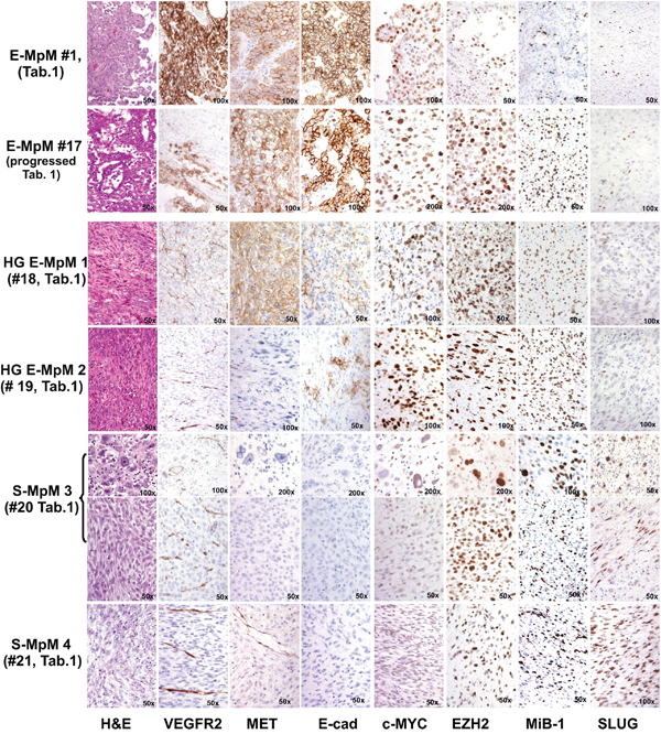 IHC findings.