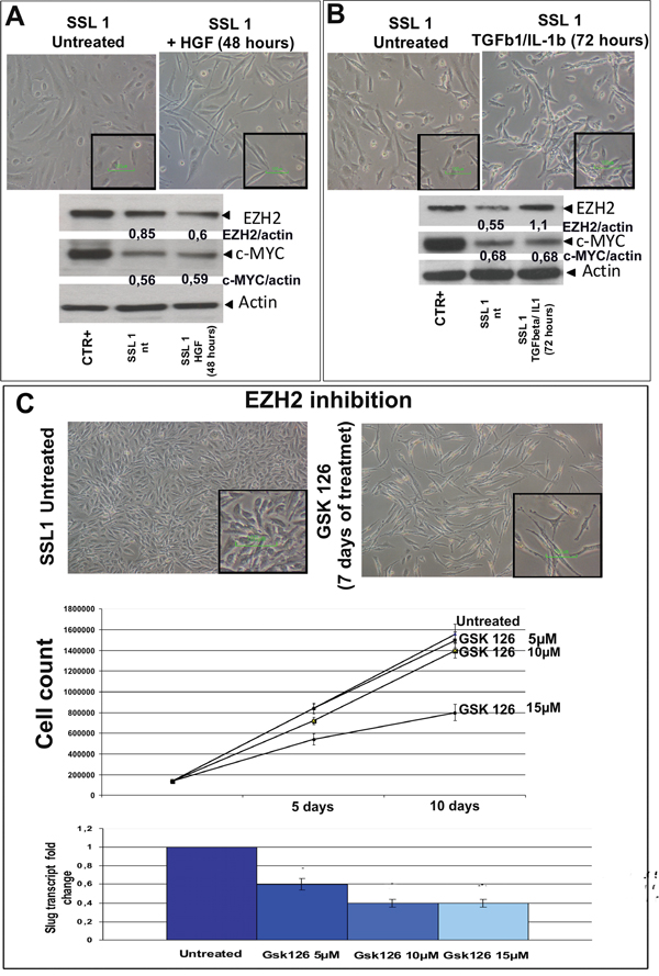 HGF, TGF&#x03B2;1/IL1b and GSK 126 treatment.