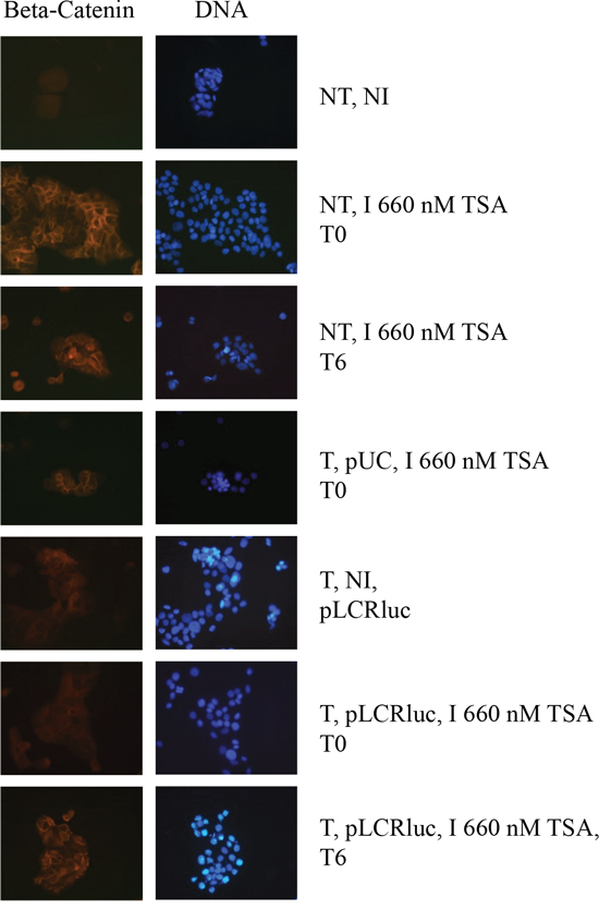 TSA induces the differentiation of keratinocytes, and this differentiation is overcome by the HPV-16 LCR.