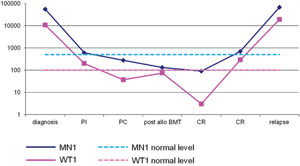 MN1 transcript (blue line) and WT1 transcript (pink line) expressed as number of copies/104 ABL copies at diagnosis and during follow-up of a patient with normal karyotype who obtained remission after chemotherapy and allogeneic bone marrow transplant and relapsed six months after transplant.